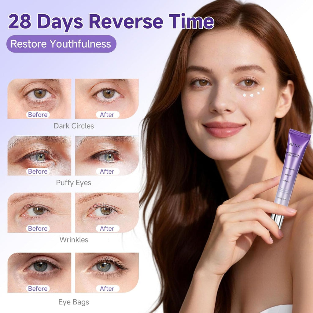 Retinol & Caffeine Eye Cream - Dark Circle Treatment & Under Eye Brightener, 0.7oz Anti-Aging Formula for Wrinkles, Puffiness, Bags